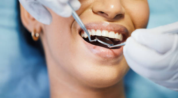 Best Emergency Tooth Extraction in Royalton, IL